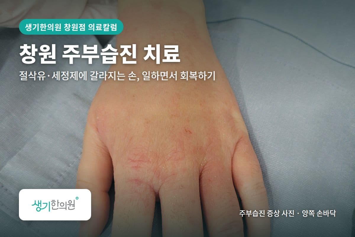 양쪽 손바닥 주부습진 증상 사진과 문구 「창원 주부습진 치료, 절삭유·세정제에 갈라지는 손, 일하면서 회복하기 · 생기한의원 창원점」