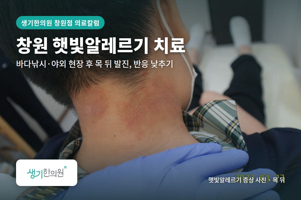 목 뒤 햇빛알레르기 증상 사진과 문구 「창원 햇빛알레르기 치료, 바다낚시·야외 현장 후 목 뒤 발진, 반응 낮추기 · 생기한의원 창원점」