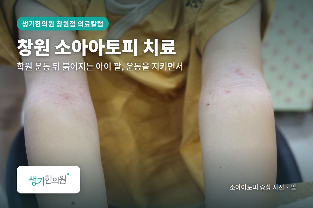 팔 소아아토피 증상 사진과 문구 「창원 소아아토피 치료, 학원 운동 뒤 붉어지는 아이 팔, 운동을 지키면서 · 생기한의원 창원점」