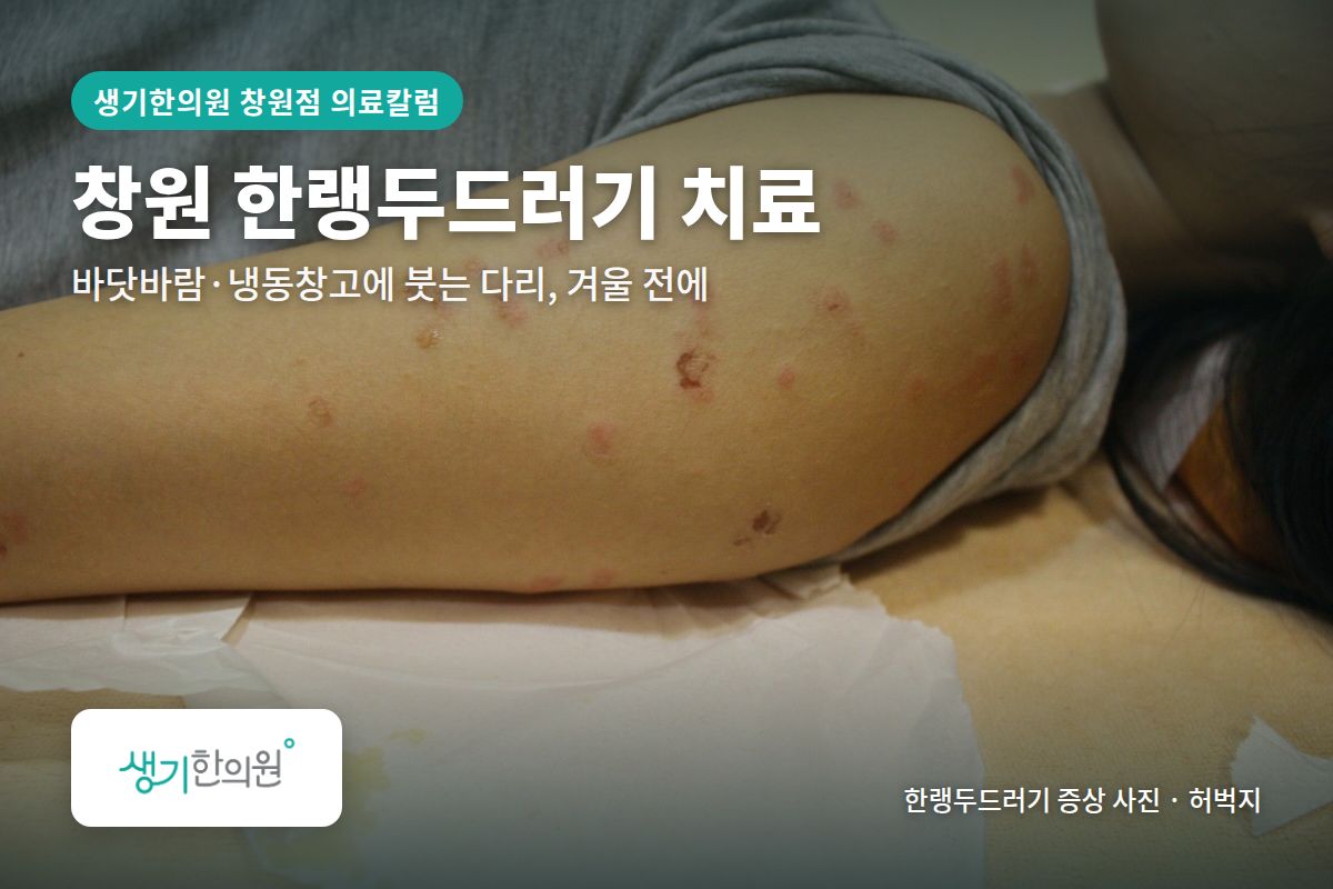 허벅지 한랭두드러기 증상 사진과 문구 「창원 한랭두드러기 치료, 바닷바람·냉동창고에 붓는 다리, 겨울 전에 · 생기한의원 창원점」