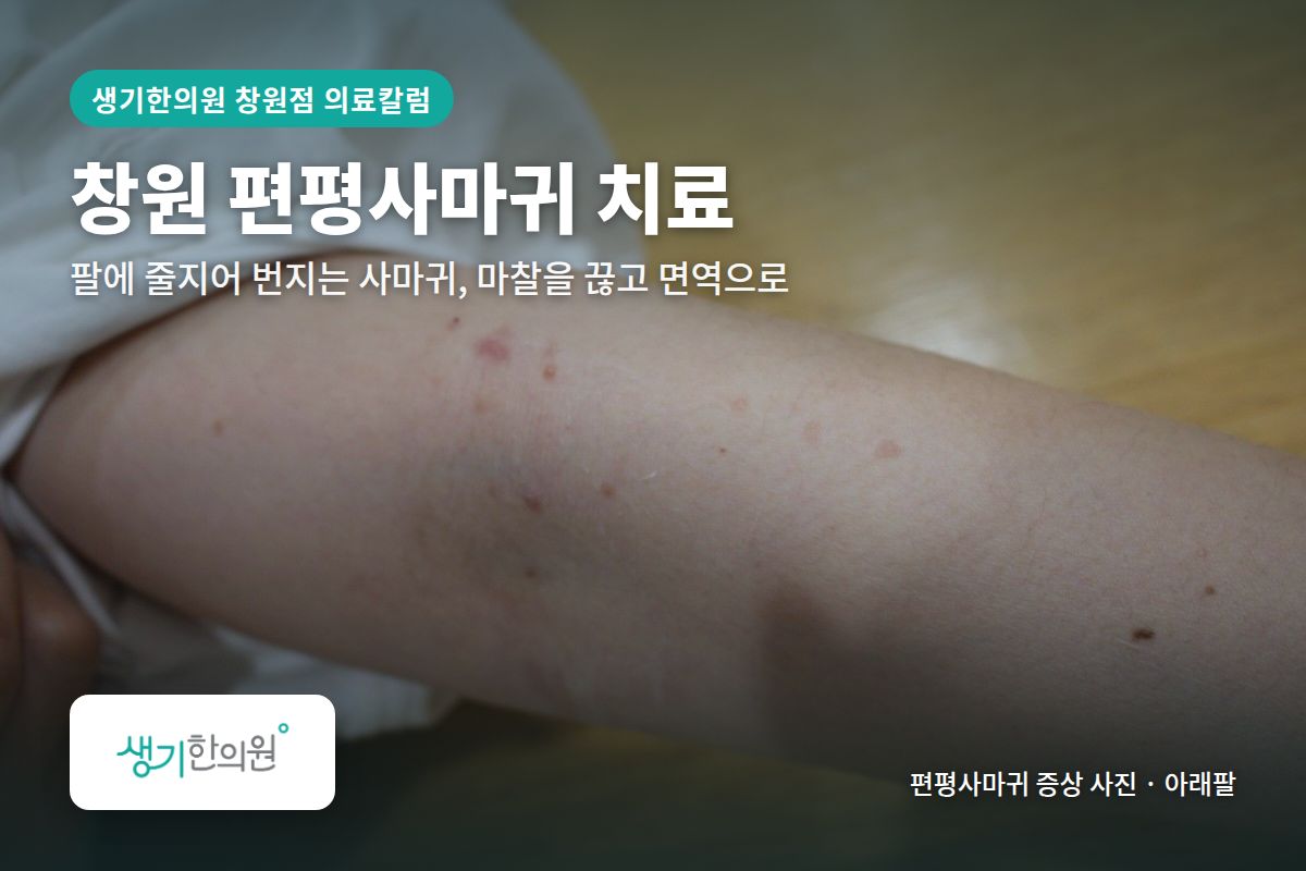 아래팔 편평사마귀 증상 사진과 문구 「창원 편평사마귀 치료, 팔에 줄지어 번지는 사마귀, 마찰을 끊고 면역으로 · 생기한의원 창원점」