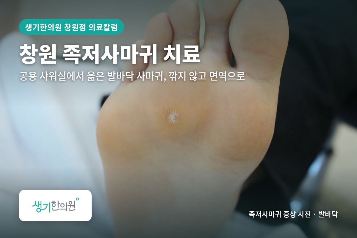 발바닥 족저사마귀 증상 사진과 문구 「창원 족저사마귀 치료, 공용 샤워실에서 옮은 발바닥 사마귀, 깎지 않고 면역으로 · 생기한의원 창원점」