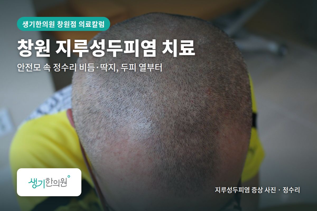 정수리 지루성두피염 증상 사진과 문구 「창원 지루성두피염 치료, 안전모 속 정수리 비듬·딱지, 두피 열부터 · 생기한의원 창원점」